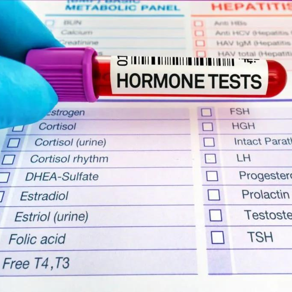 Laboratoire_analyses_hormone